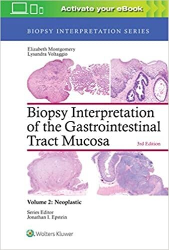 Biopsy Interpretation of the Gastrointestinal Tract Mucosa: Volume 2: Neoplastic (Biopsy Interpretation Series) Third Edition