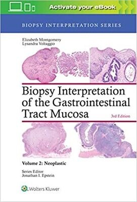 Biopsy Interpretation of the Gastrointestinal Tract Mucosa: Volume 2: Neoplastic (Biopsy Interpretation Series) Third Edition