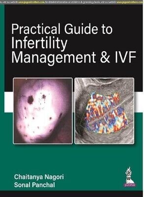 Practical Guide to Infertility Management &amp; IVF 1st Edition