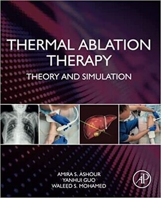 Thermal Ablation Therapy: Theory and Simulation 1st Edition