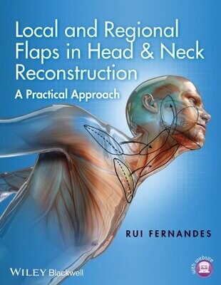 Local and Regional Flaps in Head and Neck Reconstruction: A Practical Approach 1st Edition