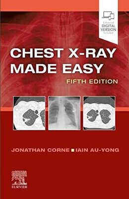 Chest X-Ray Made Easy 5th Edition