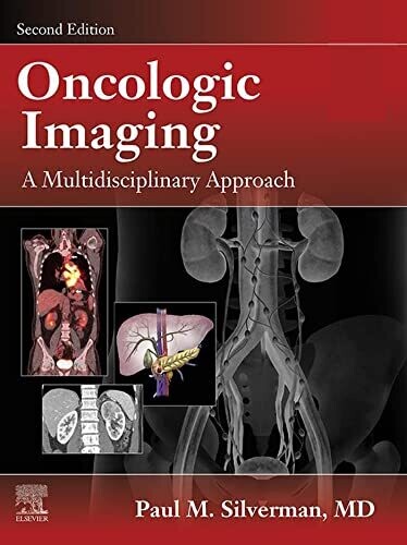 Oncologic Imaging: A Multidisciplinary Approach