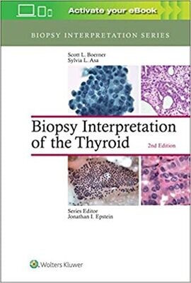 Biopsy Interpretation of the Thyroid (Biopsy Interpretation Series) Second Edition