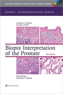 Biopsy Interpretation of the Prostate (Biopsy Interpretation Series) Fifth Edition