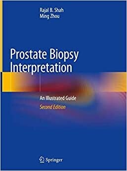 Prostate Biopsy Interpretation