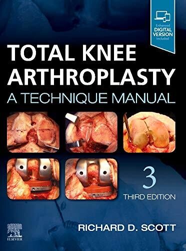 Total Knee Arthroplasty: A Technique Manual 3rd Edition
