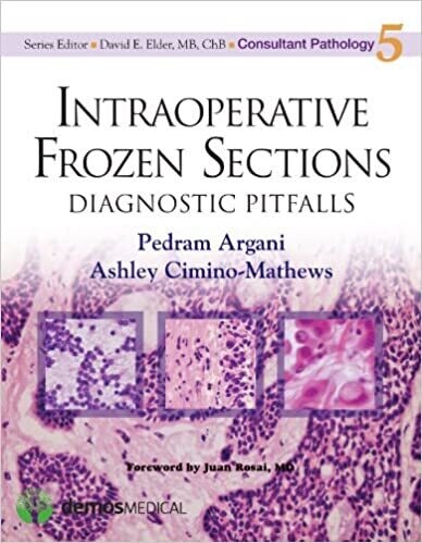 Intraoperative Frozen Sections: Diagnostic Pitfalls (Consultant Pathology, Volume 5) 1st Edition