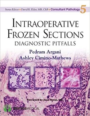 Intraoperative Frozen Sections: Diagnostic Pitfalls (Consultant Pathology, Volume 5) 1st Edition