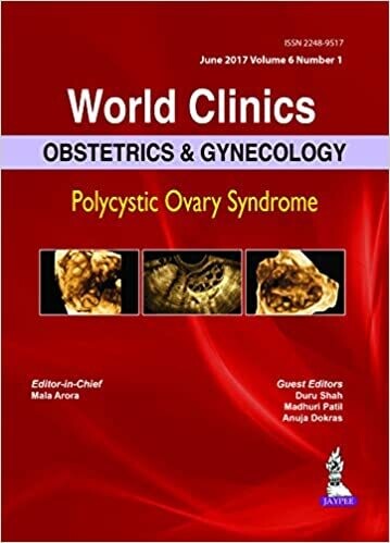 Obstetrics &amp; Gynecology: Polycystic Ovary Syndrome: Obstetrics &amp; Gynecology: Polycystic Ovary Syndrome