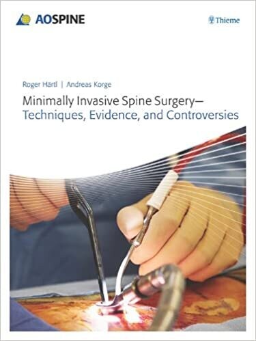 Minimally Invasive Spine Surgery: Techniques, Evidence, and Controversies