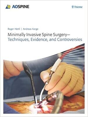 Minimally Invasive Spine Surgery: Techniques, Evidence, and Controversies