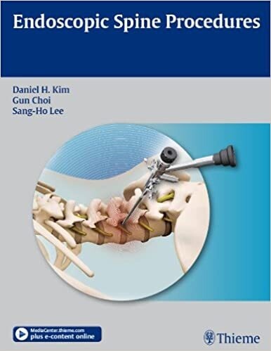 Endoscopic Spine Procedures 1st Edition