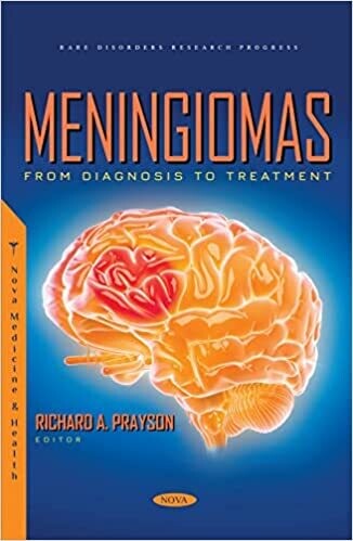 Meningiomas: From Diagnosis to Treatment