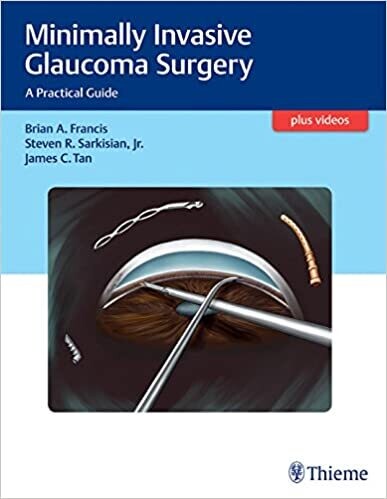 Minimally Invasive Glaucoma Surgery: A Practical Guide 1st Edition