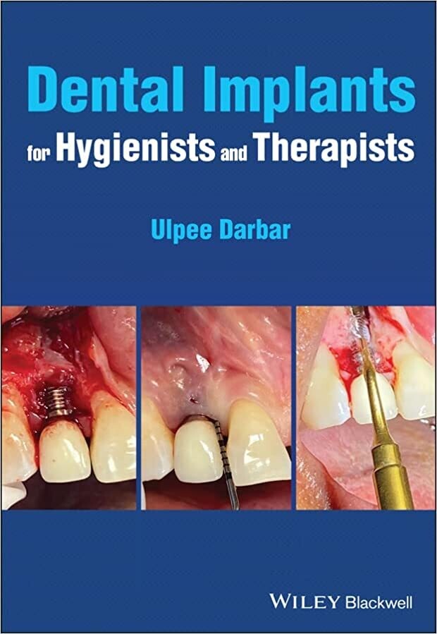 Dental Implants for Hygienists and Therapists 1st Edition