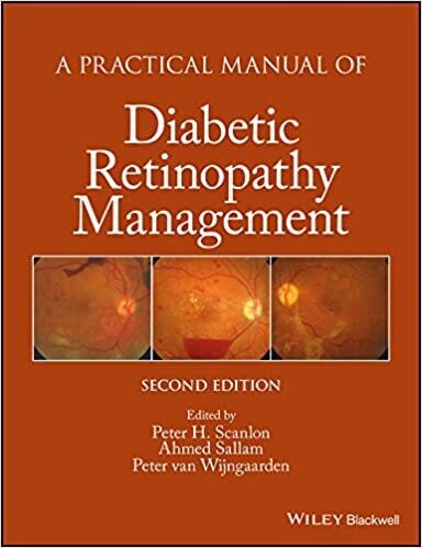 A Practical Manual of Diabetic Retinopathy Management (Practical Manual of Series) 2nd Edition