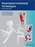 Neurointerventional Techniques: Tricks of the Trade 1st Edition