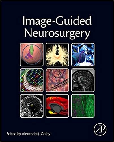 Image-Guided Neurosurgery 1st Edition