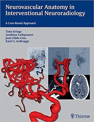 Neurovascular Anatomy in Interventional Neuroradiology: A Case-Based Approach 1st Edition