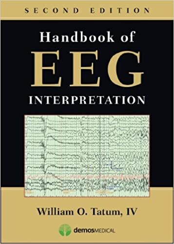 Handbook of EEG Interpretation, Second Edition 2nd Edition