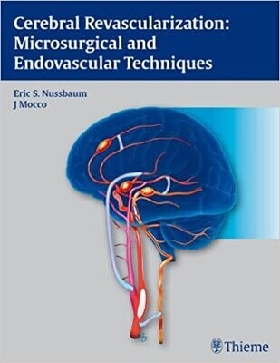 Cerebral Revascularization: Microsurgical and Endovascular Techniques 1st Edition