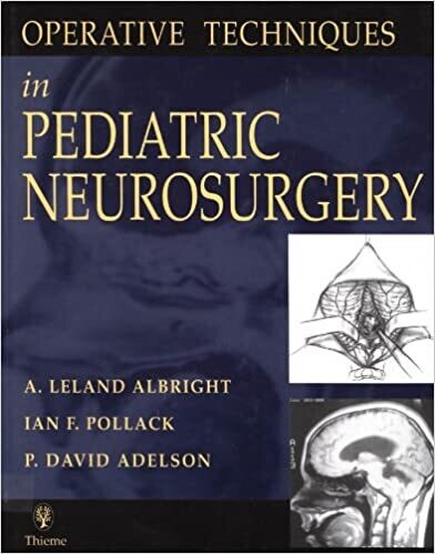 Operative Techniques in Pediatric Neurosurgery 1st Edition