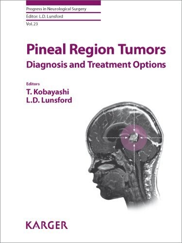 Pineal Region Tumors: Diagnosis and Treatment Options