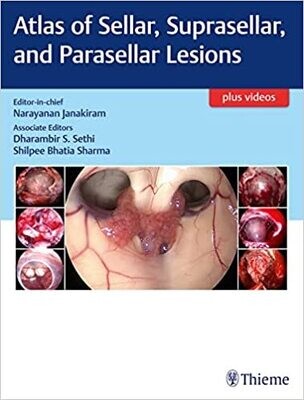 Atlas of Sellar, Suprasellar, and Parasellar Lesions 1st Edition