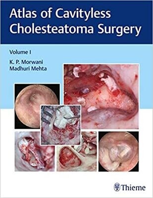 Atlas of Cavityless Cholesteatoma Surgery (Volume 1)