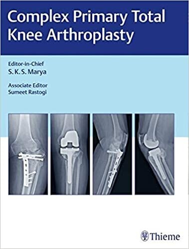 Complex Primary Total Knee Arthroplasty