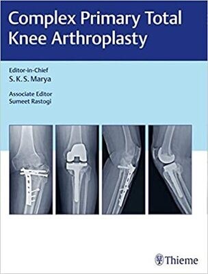 Complex Primary Total Knee Arthroplasty