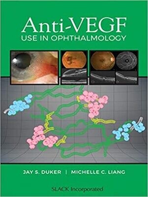 Anti-VEGF Use in Ophthalmology 1st Edition
