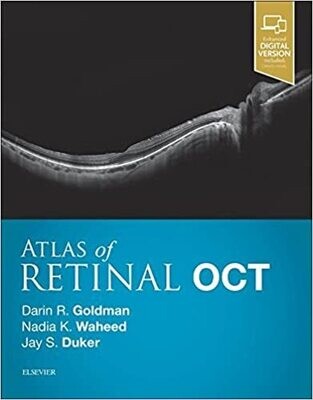 Atlas of Retinal OCT: Optical Coherence Tomography 1st Edition
