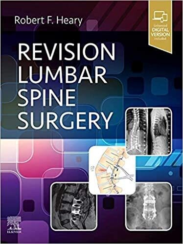 Revision Lumbar Spine Surgery E-Book 1st Edition