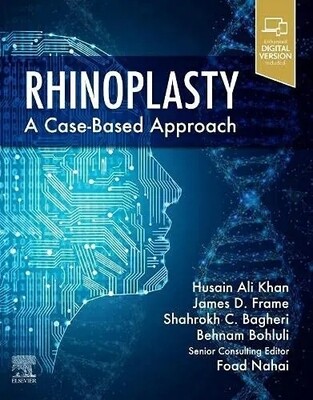Rhinoplasty A Case-Based Aproach 2022
