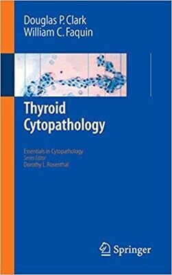 Thyroid Cytopathology (Essentials in Cytopathology Book 1)