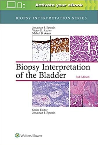 Biopsy Interpretation of the Bladder