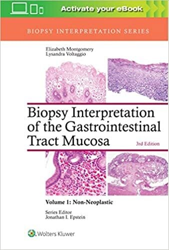 Biopsy Interpretation of the Gastrointestinal Tract Mucosa: Volume 1