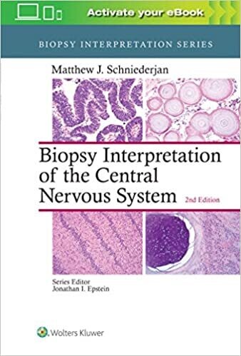 Biopsy Interpretation of the Central Nervous System