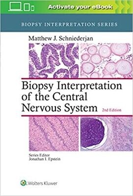 Biopsy Interpretation of the Central Nervous System