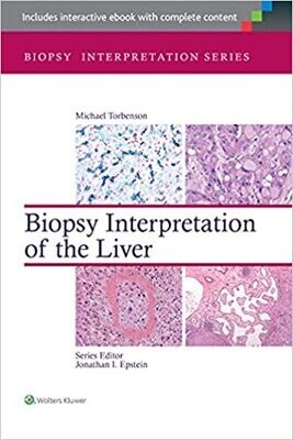 Biopsy Interpretation of the Liver (Biopsy Interpretation Series) Third Edition