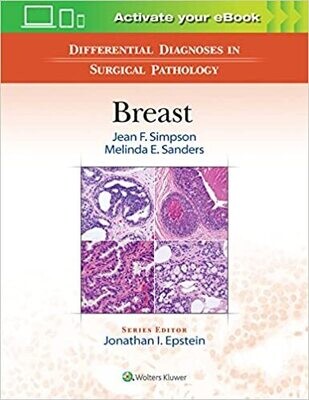 Differential Diagnoses in Surgical Pathology: Breast First Edition