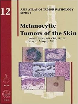 Melanocytic Tumors of the Skin (Afip Atlas of Tumor Pathology, Fourth Series Fascicle) 1st Edition