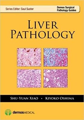 Liver Pathology (Demos Surgical Pathology Guides) 1st Edition