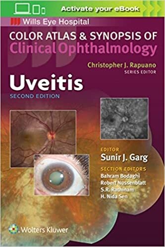 Uveitis (Color Atlas and Synopsis of Clinical Ophthalmology) Second Edition
