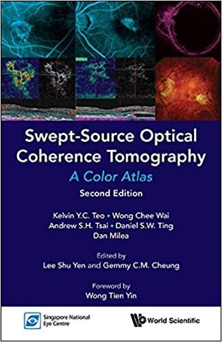 Swept-source Optical Coherence Tomography: A Color Atlas (Second Edition): A Color Atlas: Second Edition