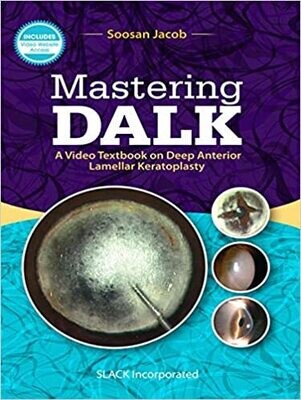 Mastering DALK: A Video Textbook on Deep Anterior Lamellar Keratoplasty 1st Edition