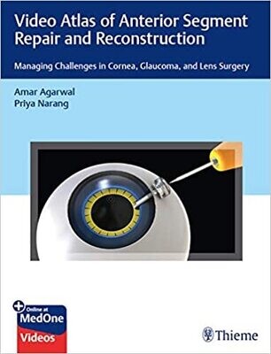 Video Atlas of Anterior Segment Repair and Reconstruction: Managing Challenges in Cornea, Glaucoma, and Lens Surgery 1st Edition