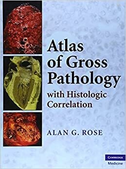 Atlas of Gross Pathology: With Histologic Correlation 1st Edition